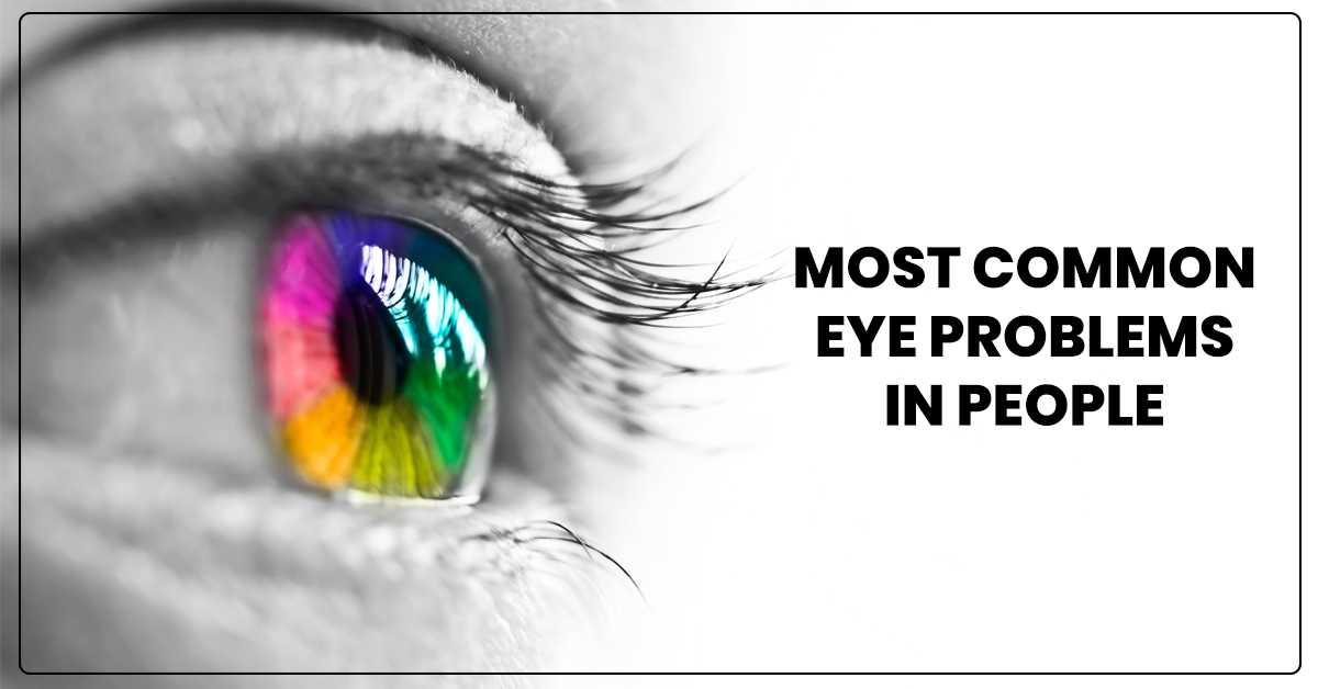 Most common eye problems in people
