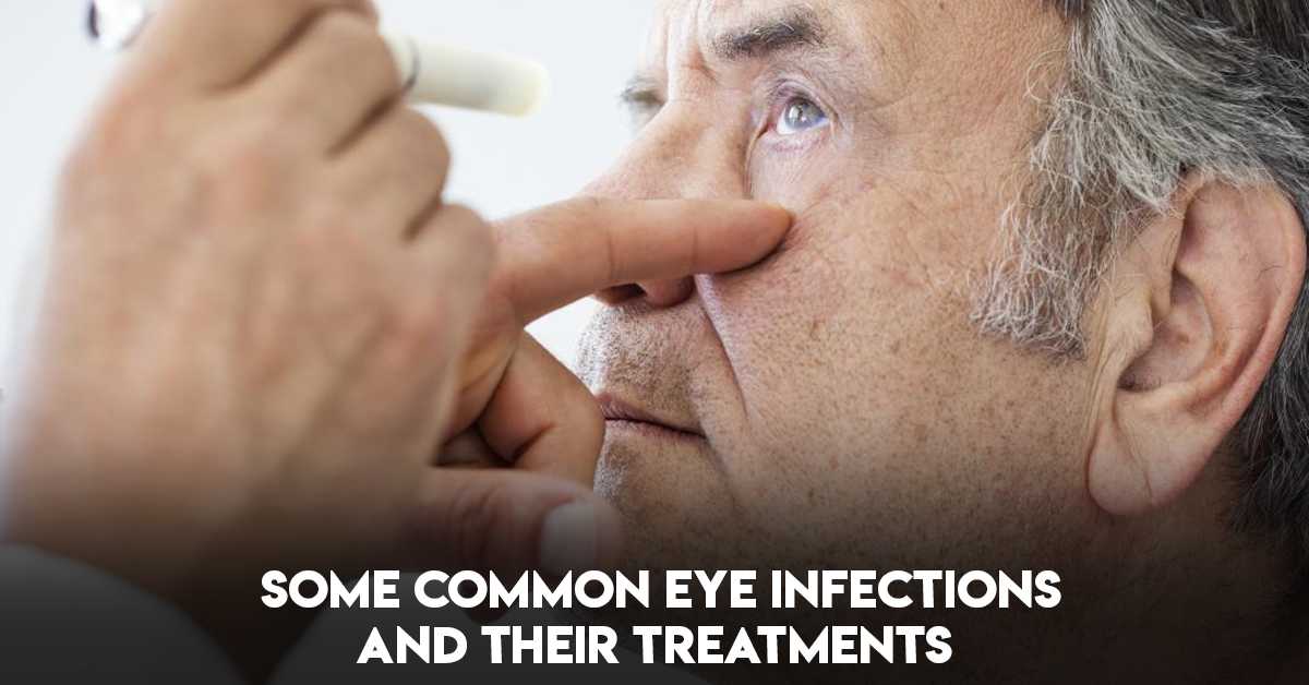 Some Common Eye Infections and Their Treatments