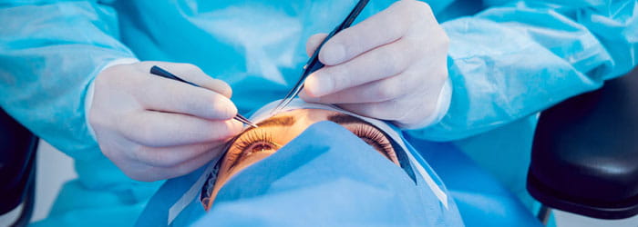 Phacoemulsification for Cataracts at Eye Hospital in Siliguri